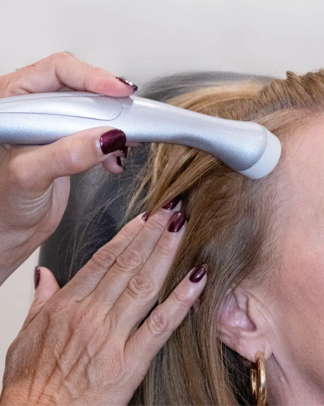 Close-up of a scalp applicator delivering hair restoration serum in Dayton, Ohio